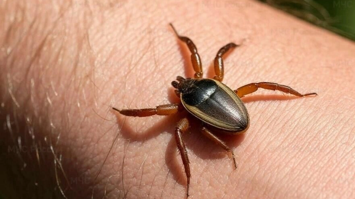 В Калужской области начали просыпаться клещи: уже зарегистрирован первый случай укуса